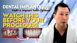 Dental Implants 101: What You NEED to Know! Part 4 (Implant Teeth Options) by North Texas Dental Surgery 13,447 views 1 year ago 19 minutes