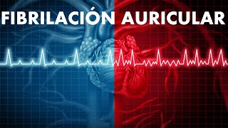 Atrial fibrillation: causes, symptoms, diagnosis and treatment