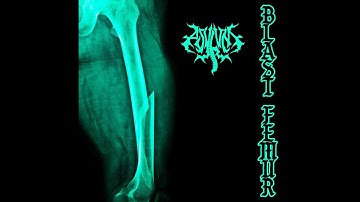 ASYLUM - Blast Femur (Single)