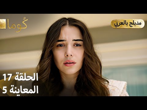 Kuma ك وما مسلسل تركي الحلقة 17 ترويج 05 Arabic Dubbed