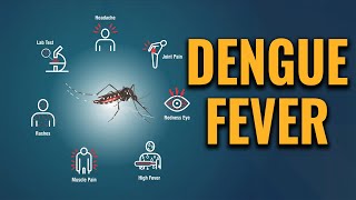 Dengue fever - Symptoms and causes by Doctor Mike Hansen 33,082 views 8 months ago 7 minutes, 35 seconds