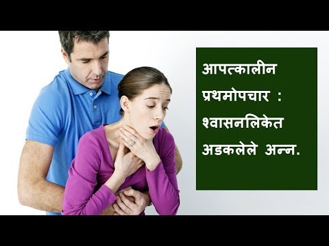 एखाद्या व्यक्तीच्या घशात अडकले असेल तर काय कराल | First Aid Emergency Choking | HelloDox