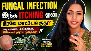 That Persistent Itch? Here's What It Means | Fungal Infection Explained | Tamil