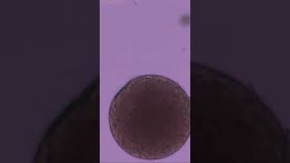 Sea urchin fertilization 2 #shorts