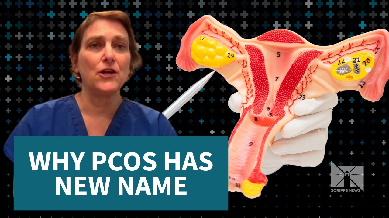 Pmos Female PCOS is now called PMOS — doctor explains why and what it means for ...