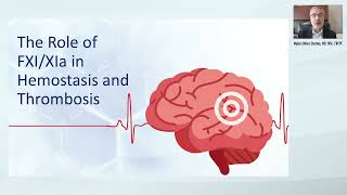 Rethinking Secondary Stroke Prevention: The Emerging Role of Factor XI Inhibition