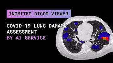 COVID-19 Lung Damage Assessment by AI Service