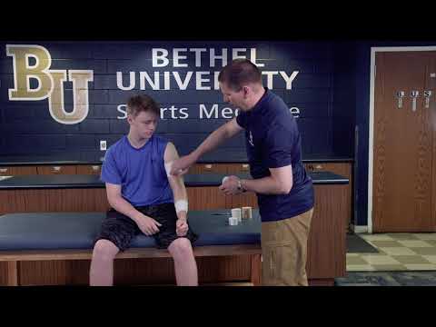 Video: Hyperextended Elbow: Symptómy, Liečba A ďalšie