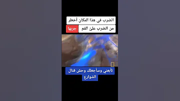 أخطر اماكن الضرب في جسم الانسان 