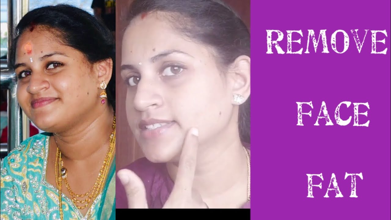 How to reduce Face fat in Telugu || Get slim Face In 1 week ||Get rid