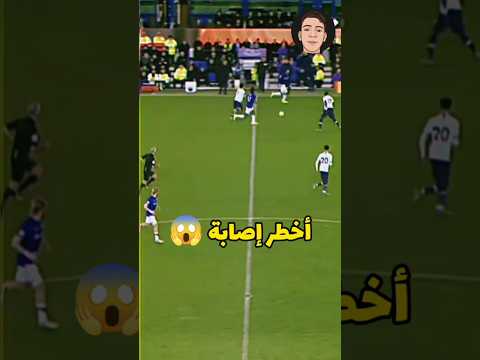 فيديو: هل يدعي لاعبو كرة القدم الإصابات؟