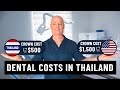 Dental costs in thailand vs usa 