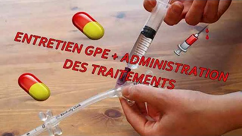 Quand mettre une gastrostomie ?