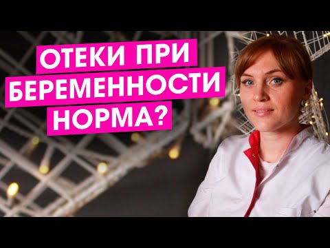 Отеки при беременности. Что делать? Это страшно? Правильная профилактика отеков. Как лечить. Видео.