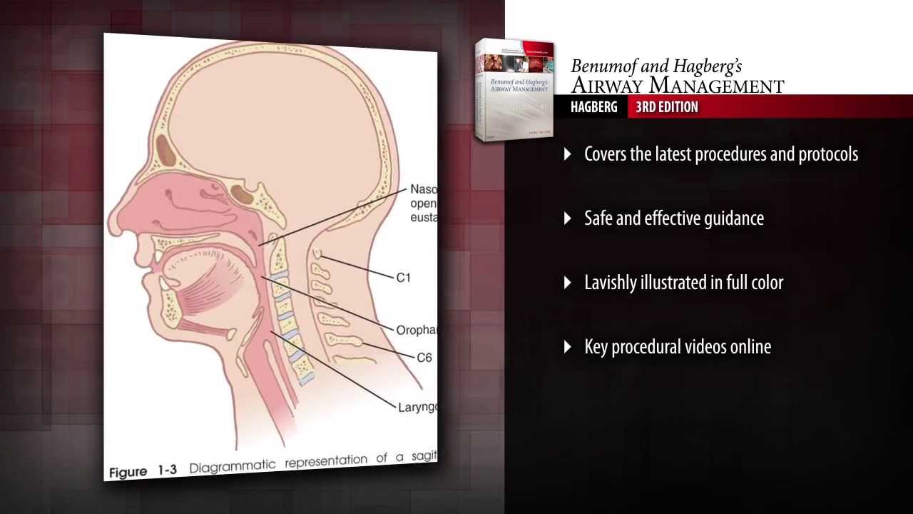Benumof and Hagbergs Airway Management