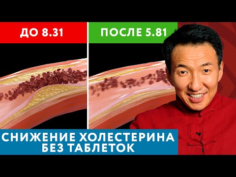 КАК снизить ХОЛЕСТЕРИН БЕЗ ТАБЛЕТОК? Это возможно! // #чжудши #тибетскаямедицина #холестерин
