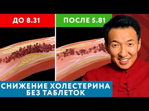 Видео: КАК снизить ХОЛЕСТЕРИН БЕЗ ТАБЛЕТОК? Это возможно! // #чжудши #тибетскаямедицина #холестерин