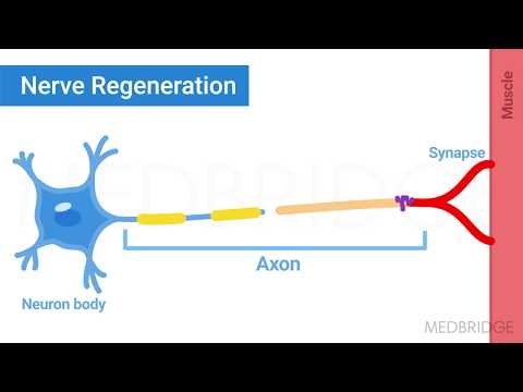 Post Surgical Management Part 1: Basic Principles and Spinal Surgery - Haideh V Plock | MedBridge