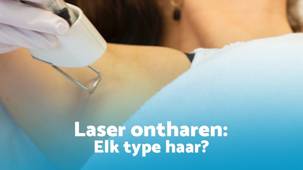 Kan elk type haar gelaserd worden?