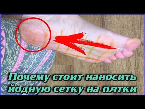 Проще не придумаешь Вот что произойдет, если нанести немного ЙОДА НА ПЯТКИ Польза для здоровья