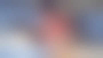 Inion Freedom Plate system for fracture fixation