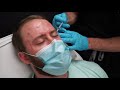 Male Botox - "Brotox" - With Dr. Rebowe at The Park Clinic