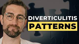 Diverticulitis Treatment Without the One-Size-Fits-All Approach