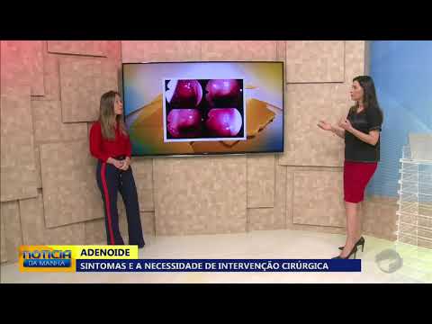 Vídeo: Inflamação Das Adenóides Em Crianças E Adultos: Tratamento, Sintomas, Sinais