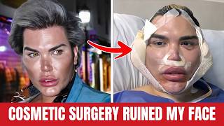 15 Celebrity Plastic Surgery Disasters You Won't Believe Are Real Today | Then and Now 2026