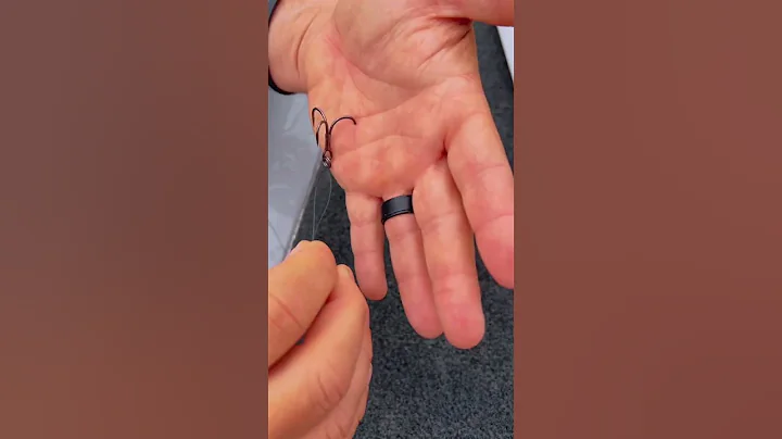 How To Remove A Hook (Deep In The Hand) #shorts - DayDayNews
