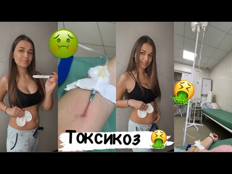 УЖАСНЫЙ ТОКСИКОЗ! 🤮 Как я спасалась от токсикоза|Мой первый триместр беременности 🤰🏼  #токсикоз