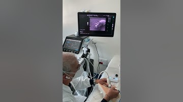 RFA Training_Demonstrated by Dr. Stefano Spiezia