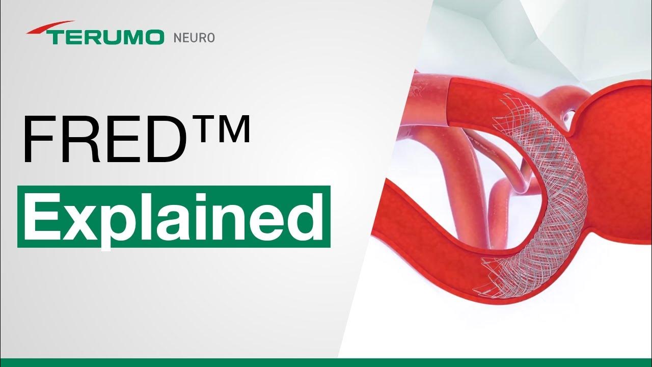 FRED™ System Overview YouTube