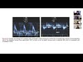 Diastolic LVEDP