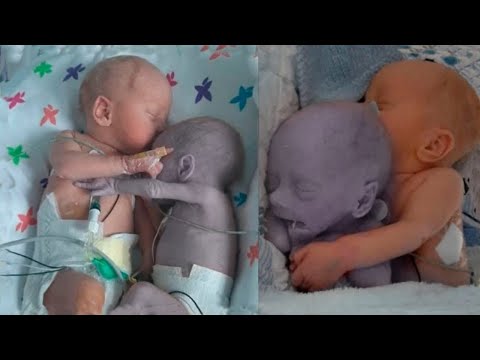 Video: Wie heißen Krankenschwestern, die Babys zur Welt bringen?