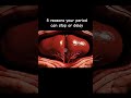 5 reasons your period can stop or delay #menstrualcycle #biology #shortsfeed #youtubeshorts