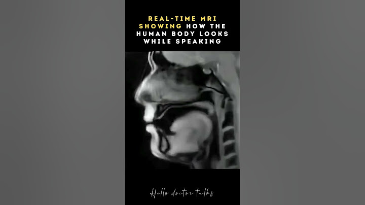 Ever wondered what speaking looks like from the inside? #healthchannel #doctor #doctorslife #ask