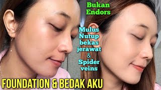 HALUS BANGET!!! BEKAS JERAWAT FLEK HITAM DAN SPIDER VEINS TERSAMARKAN! AWET DAN NGGAK MENOR!