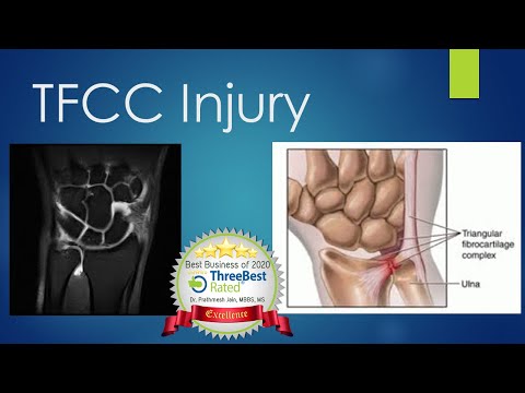 TFCC Injury How? Problem Treatment Diagnosis