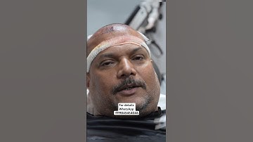 CID Actor Daya Hair Transplant Result #celebrityhairtransplant #hair #bollywood #viral