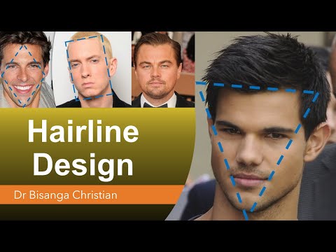 FUE Hairline Design: