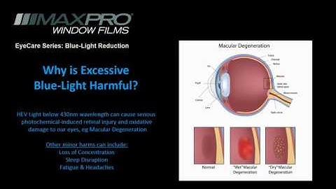 Eyecare Maxpro Window Films