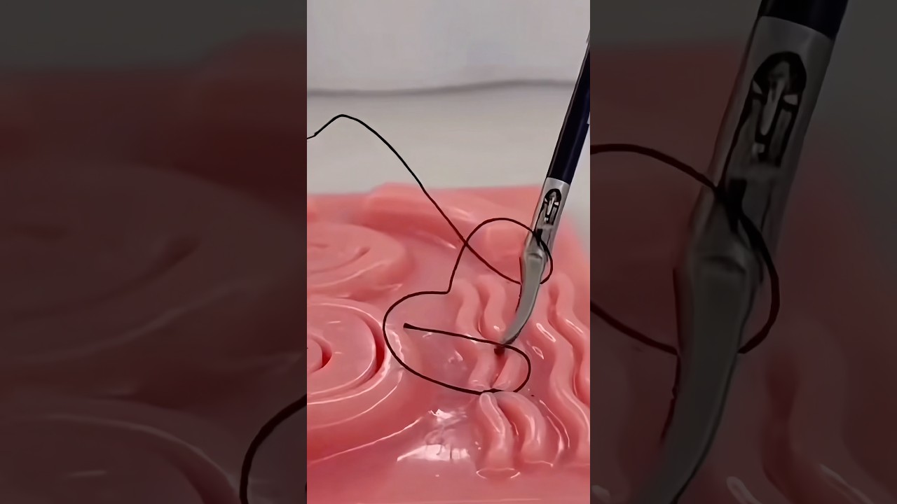 This is Keyhole Surgery 😷