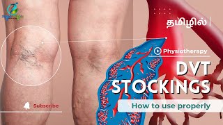 dvt stockings how to wear | compression stockings benefits | dvt treatment in tamil | physiotherapy