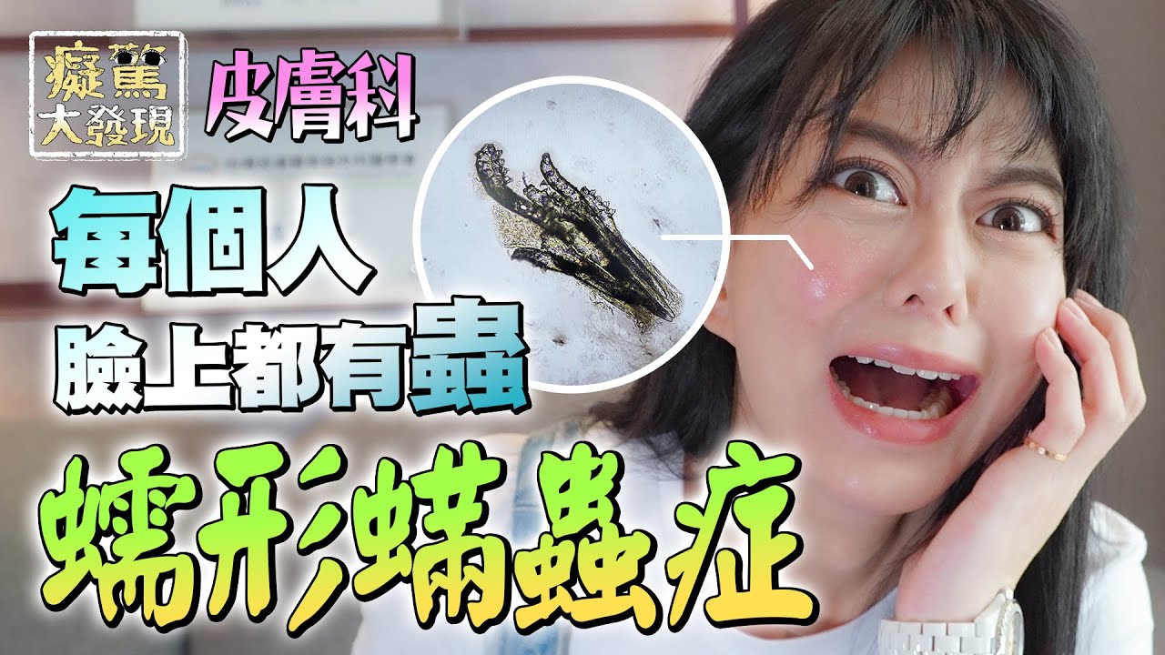 臉常泛紅發癢？你的毛孔可能已經爬滿蟲！｜白癡公主 #癡驚大發現