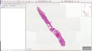 QuPath 101: Determining Area of Biopsy Cores