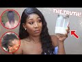 WATCH THIS BEFORE USING RICE WATER ON YOUR HAIR! THE TRUTH ABOUT RICE WATER FOR MASSIVE HAIR GROWTH