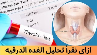 ازاي نقرا تحليل الغده الدرقيه | Thyroid function test