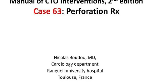 Case 63: Manual of CTO Interventions - Large vessel perforation