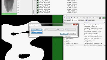 MicroCT analysis of the tooth, Part 1: the root canal